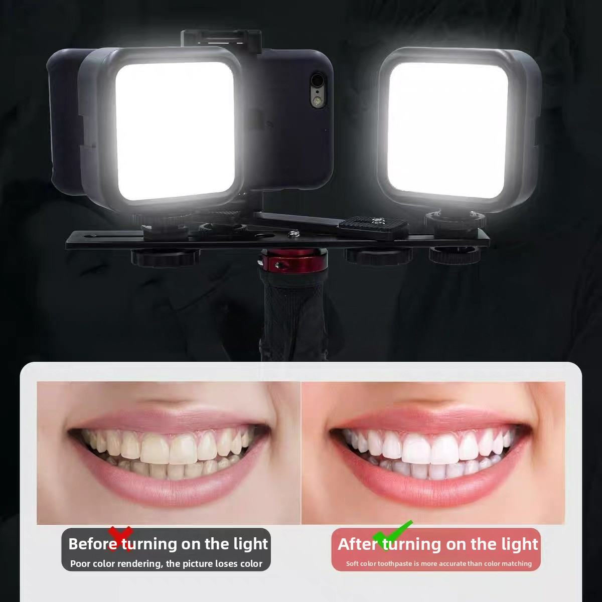 Dental Photography Light with  - Photography Basics recension och pris